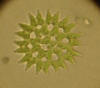 Picture of Pediastrum alga
